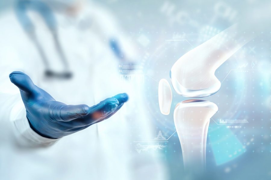 Cirurgia do joelho avan&ccedil;a com rob&oacute;tica e pr&oacute;teses 3D, mas acesso ainda &eacute; limitado no Brasil