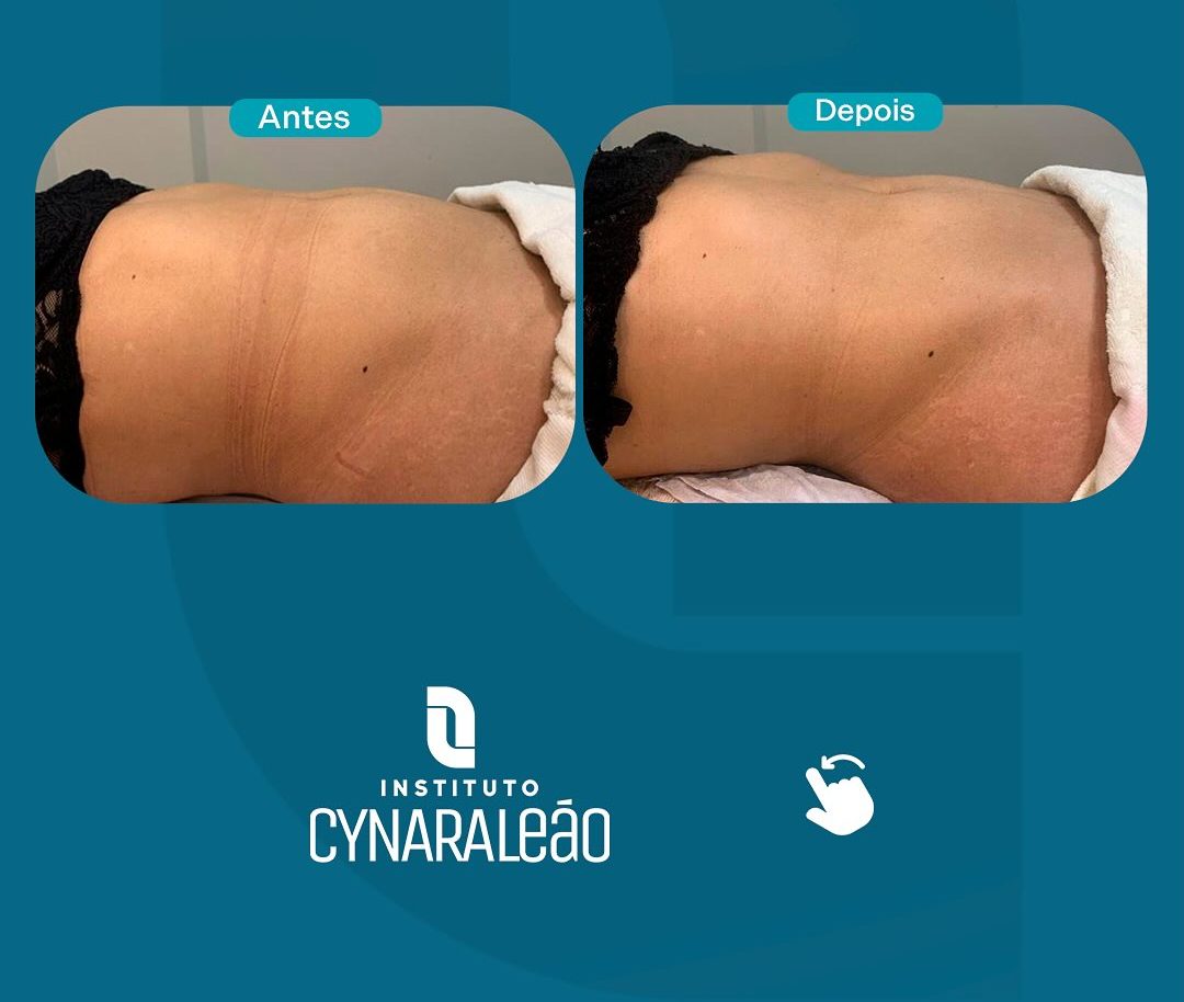 Instituto Cynara Le&atilde;o oferece protocolos personalizados de detox corporal para come&ccedil;ar a semana com leveza
