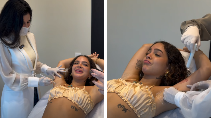 Mel Maia fala sobre inseguran&ccedil;a e revela que fez botox nas axilas; entenda o procedimento