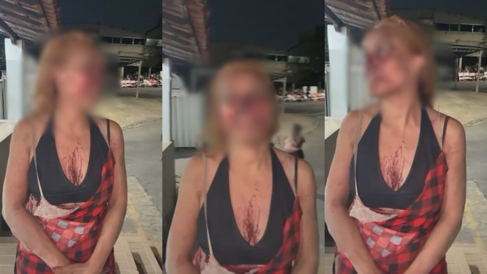 Advogada &eacute; espancada por vizinhas ap&oacute;s briga por lixo em Betim MG