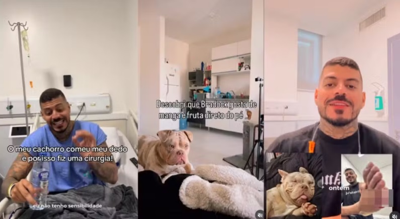 Influenciador perde dedo do p&eacute; ap&oacute;s cachorro ‘comer’ seu dedo enquanto dormia