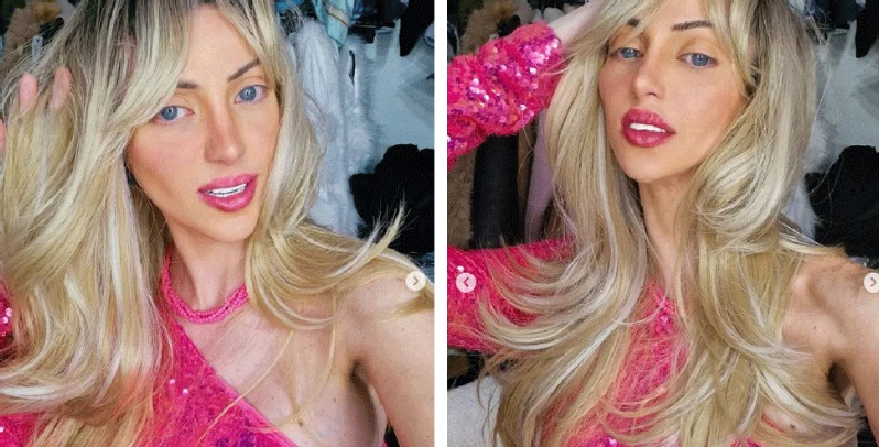 O que realmente matou a &ldquo;Barbie humana&rdquo;? Laudos revelam causa da morte
