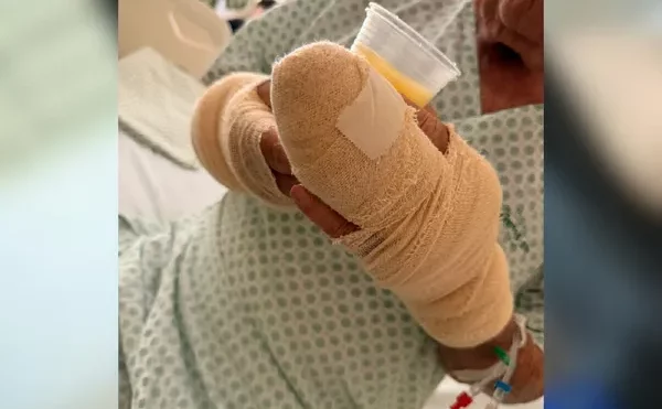 Idoso de 83 anos &eacute; gravemente ferido por pitbull em Palmas; tutora &eacute; conduzida &agrave; delegacia