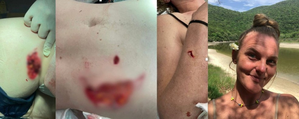 Mulher &eacute; atacada por capivara durante mergulho em SC e perde parte da n&aacute;dega