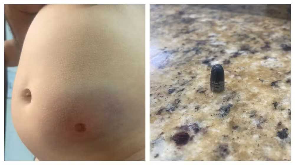 Beb&ecirc; fica ferida por bala perdida durante confraterniza&ccedil;&atilde;o de Ano Novo, em Tiradentes SP