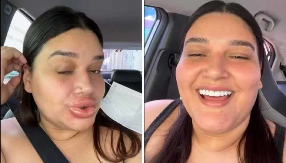 Maquiadora de Gurupi viraliza ap&oacute;s incha&ccedil;o extremo nos l&aacute;bios