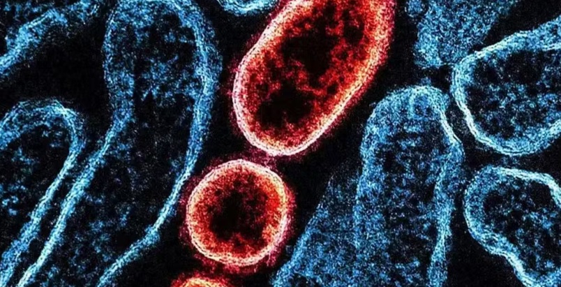 Nipah pode virar pandemia? Entenda por que o v&iacute;rus pouco conhecido pode ser mais letal que a Covid-19
