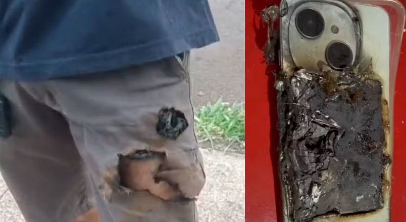 &ldquo;Tinha 20 dias de uso, mas salvou minha vida&rdquo;: cachorro morde celular durante ataque e aparelho explode no bolso