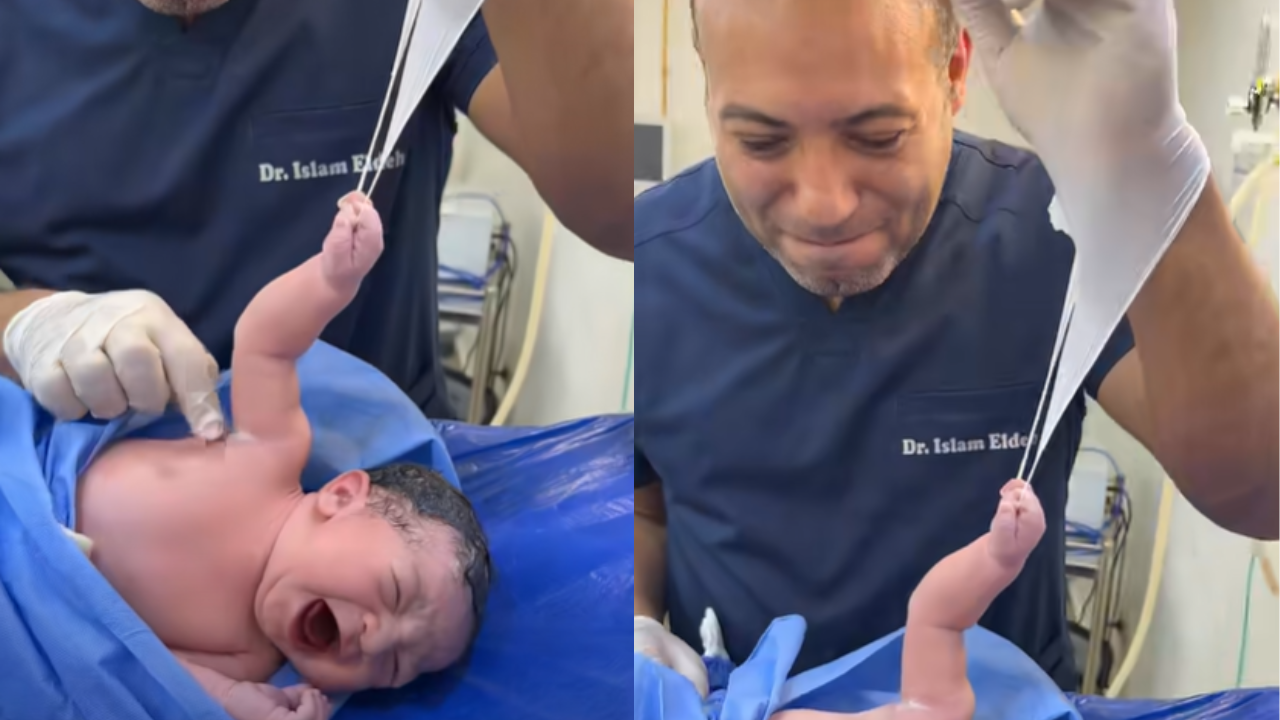 Beb&ecirc; rec&eacute;m-nascido “agarra” luva de m&eacute;dico logo ap&oacute;s o parto e viraliza