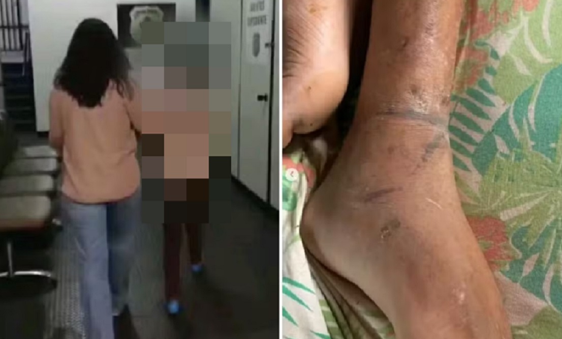 Filho mantido acorrentado pela m&atilde;e sofreu tr&ecirc;s AVCs e era obrigado a comer fezes