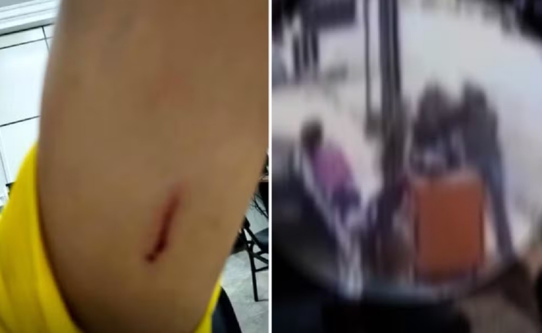 Funcion&aacute;ria &eacute; atacada com tesoura ap&oacute;s fotografar colega usando celular em churrascaria