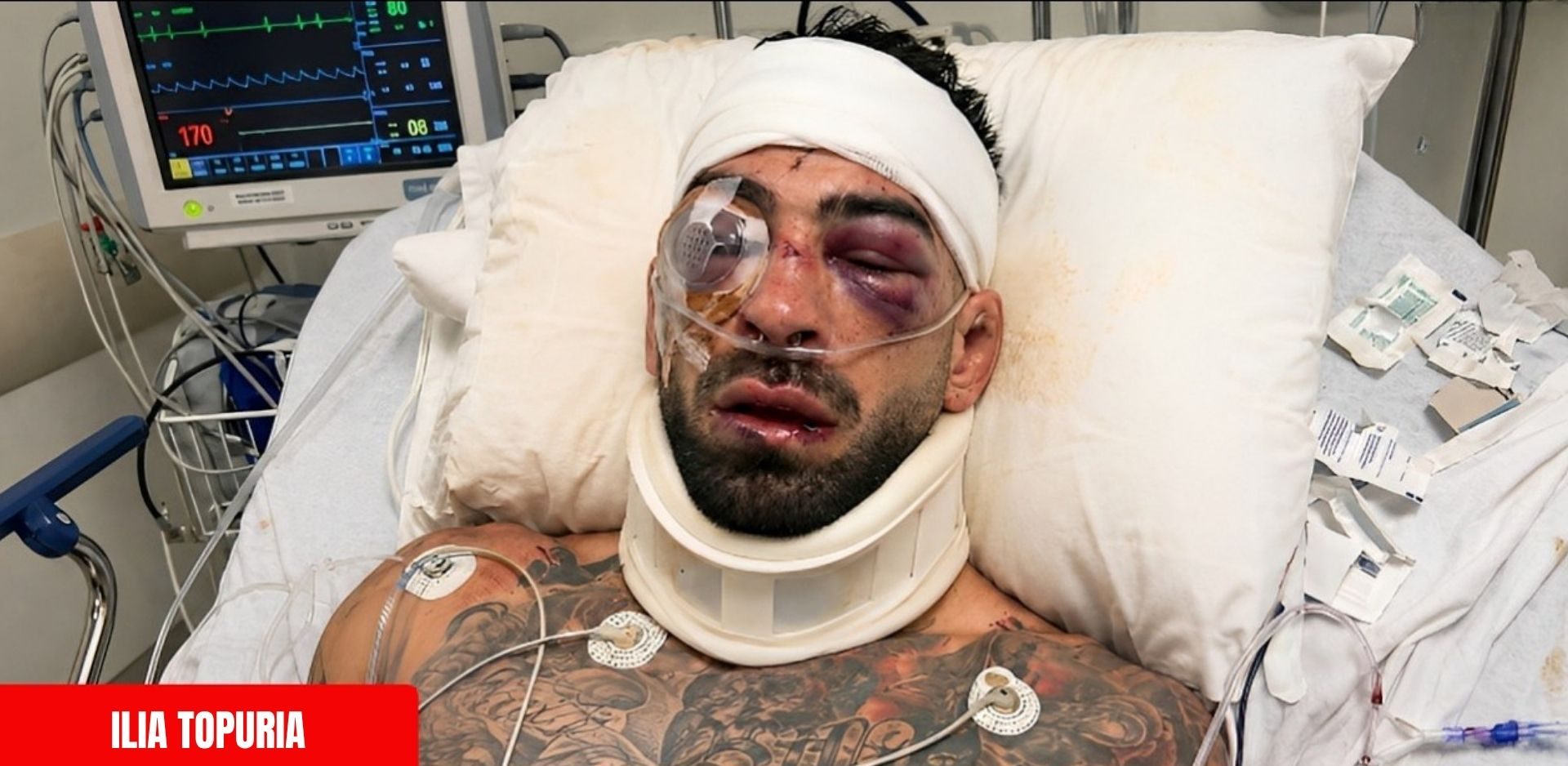 Topuria sofre fraturas no rosto ap&oacute;s UFC Casa Branca e recebe suspens&atilde;o de 180 dias