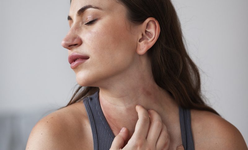Voc&ecirc; pode ter uma alergia e n&atilde;o saber; veja os sinais e como identificar o problema