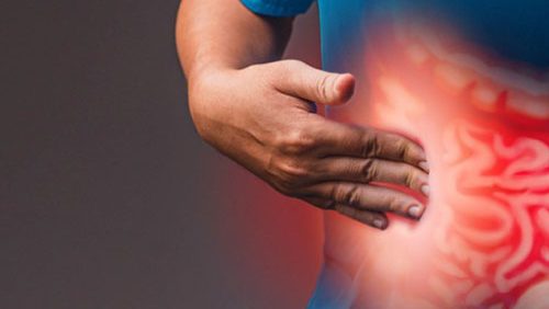 C&acirc;ncer de intestino: sinais, preven&ccedil;&atilde;o e diagn&oacute;stico