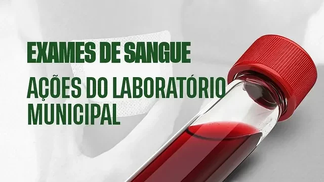 Concei&ccedil;&atilde;o do Tocantins abre agendamento para exames de sangue gratuitos